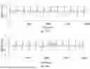 Fig. 36 - Multifunction Newborn Gavage Tube