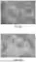 Fig. 08 - PARENTERAL NUTRITION FORMULATION