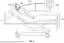 Fig. 02 - TRACHEOSTOMY TUBE WITH DECANNULATION-RESISTANT SECUREMENT DEVICE