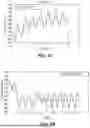 Fig. 03 - Methods and Systems for Lowering Blood Pressure Through Reduction of Ventricle Filling