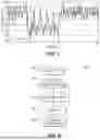 Fig. 06 - Methods and Systems for Lowering Blood Pressure Through Reduction of Ventricle Filling