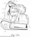 Fig. 20 - Bed Exercise Systems and Methods