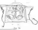 Fig. 28 - Bed Exercise Systems and Methods