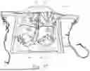 Fig. 29 - Bed Exercise Systems and Methods