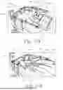 Fig. 61 - Bed Exercise Systems and Methods