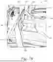 Fig. 63 - Bed Exercise Systems and Methods