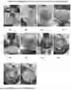 Fig. 08 - POWDER BLEND SEGREGATION TESTING APPARATUS AND RELATED METHODS