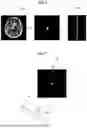 Fig. 07 - IMAGE PROCESSING APPARATUS, METHOD, AND PROGRAM