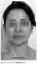 Fig. 09 - CEPHALOMETRIC PARAMETERS FOR ASSESSING THE HARMONY, AESTHETICS AND PROPORTIONS OF THE FACE