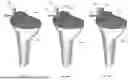 Fig. 17 - METHODS FOR PROTECTING ANATOMICAL STRUCTURES FROM RESECTION AND DEVICES THEREOF