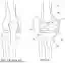 Fig. 03 - HIGH-PROFILE, ANATOMY-SPECIFIC IMPLANTS FOR COMBINED HARD AND SOFT TISSUE RECONSTRUCTION WITH EMBEDDED TECHNOLOGY FOR MEDICINE DELIVERY