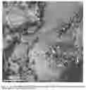 Fig. 02 - Method for Producing Silver Nanoparticles in an Active Carious Lesion