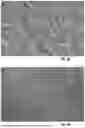 Fig. 26 - MEDICAL DEVICE WITH MULTI-LAYER COATING INCORPORATING CATIONIC STEROIDAL ANTIMICROBIALS