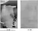 Fig. 20 - DUAL-LAYER GAS FILTERS AND SYSTEMS AND METHODS FOR MAKING THE SAME
