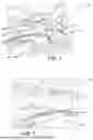 Fig. 02 - VEHICLE FORWARD BLIND SPOT OBJECT DETECTION SYSTEM