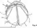 Fig. 05 - ECCENTRIC SCREW PUMP