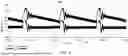 Fig. 09 - ION CURRENT DROOP COMPENSATION