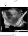Fig. 02 - SYSTEM AND METHODS FOR LOCATING DRIVERS OF ATRIAL FIBRILLATION