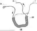 Fig. 01 - KNOTLESS SUTURE ANCHORS