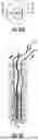 Fig. 16 - KNOTLESS SUTURE ANCHORS