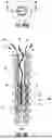 Fig. 20 - KNOTLESS SUTURE ANCHORS