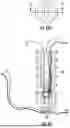 Fig. 29 - KNOTLESS SUTURE ANCHORS