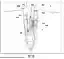 Fig. 37 - KNOTLESS SUTURE ANCHORS