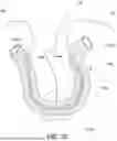 Fig. 49 - KNOTLESS SUTURE ANCHORS