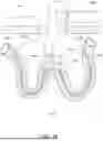 Fig. 56 - KNOTLESS SUTURE ANCHORS