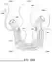 Fig. 60 - KNOTLESS SUTURE ANCHORS