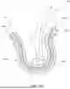 Fig. 62 - KNOTLESS SUTURE ANCHORS