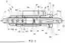Fig. 03 - BONE SHORTENING OSTEOTOMY APPARATUS