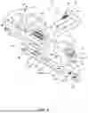 Fig. 04 - BONE SHORTENING OSTEOTOMY APPARATUS