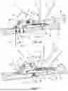 Fig. 08 - BONE SHORTENING OSTEOTOMY APPARATUS