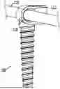 Fig. 01 - ANCHOR DEVICE FOR BONE IMPLANTATION DURING SURGICAL PROCEDURES