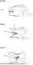 Fig. 08 - Instruments for human orthopaedic surgery for installing expandable bone implants