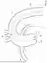 Fig. 09 - GUIDEWIRE FOR IMPROVED REPLACEMENT HEART VALVE DELIVERY