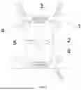 Fig. 02 - NOVEL 3D PRINTING SELF-STABILIZING CERVICAL INTERBODY FUSION CAGE