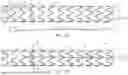 Fig. 02 - RADIALLY ADJUSTABLE STENT GRAFT DELIVERY SYSTEM AND METHOD OF USE