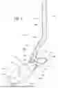 Fig. 02 - ANKLE-FOOT ORTHOSIS AND METHOD FOR MAKING THE SAME