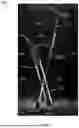 Fig. 02 - Crutch with Integrated Fold-Out Sling, Telescoping Frame for Compact Transport, and Leg Elevation Mechanism