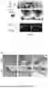 Fig. 06 - Silk Fibroin/Tea Polyphenol Hydrogel and Preparation Method and Application Thereof