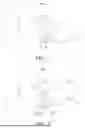 Fig. 02 - NOVEL PRESSURE-CONTROLLED EXHALE RELIEF VALVE