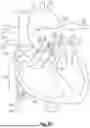 Fig. 04 - CORKSCREW SHAPE FOR RIGHT-SIDED CARDIAC DEVICE