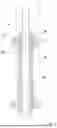Fig. 09 - CLEANING OF AN INJECTION MOLDING TOOL