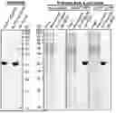 Fig. 01 - EPITOPE TAGS RECOGNIZED BY SPECIFIC BINDERS