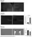 Fig. 11 - GENE THERAPY TREATMENT