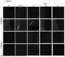 Fig. 13 - GENE THERAPY TREATMENT