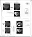 Fig. 01 - EJECTION FRACTION FROM NON-CONTRAST COMPUTED TOMOGRAPHY