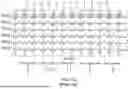 Fig. 04 - MULTIBEAM ARRAY ANTENNAS WITH STABLE BEAM PEAKS AND BEAM WIDTHS THROUGH MULTIPLEXERS